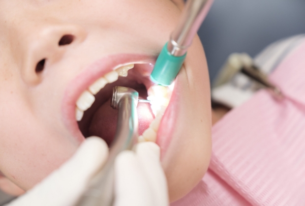 子どもの虫歯治療の麻酔